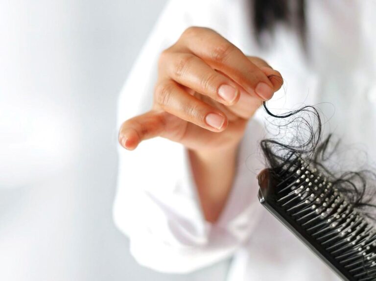 Tips for Managing Hair Loss