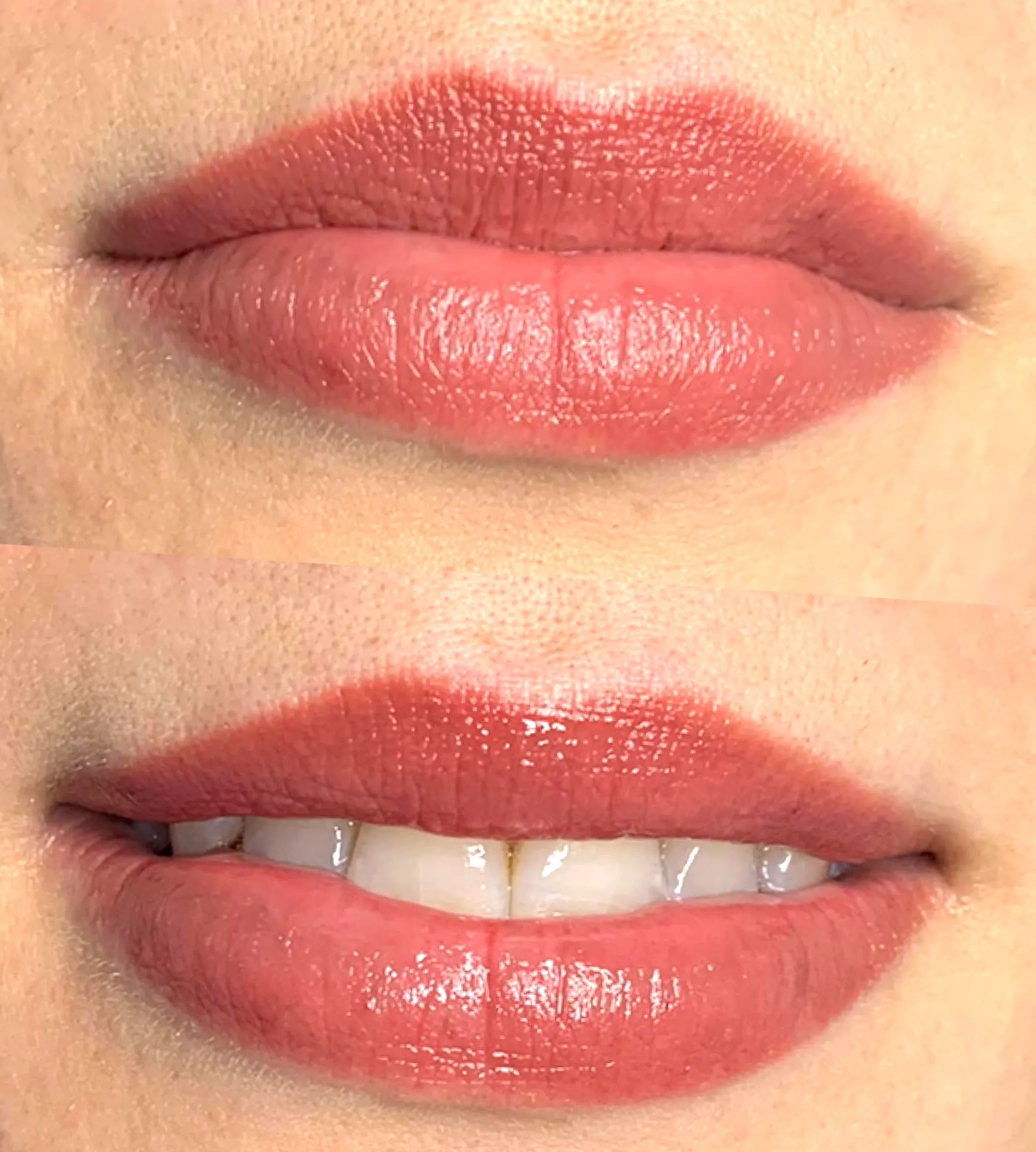saline removal lip tattoo
