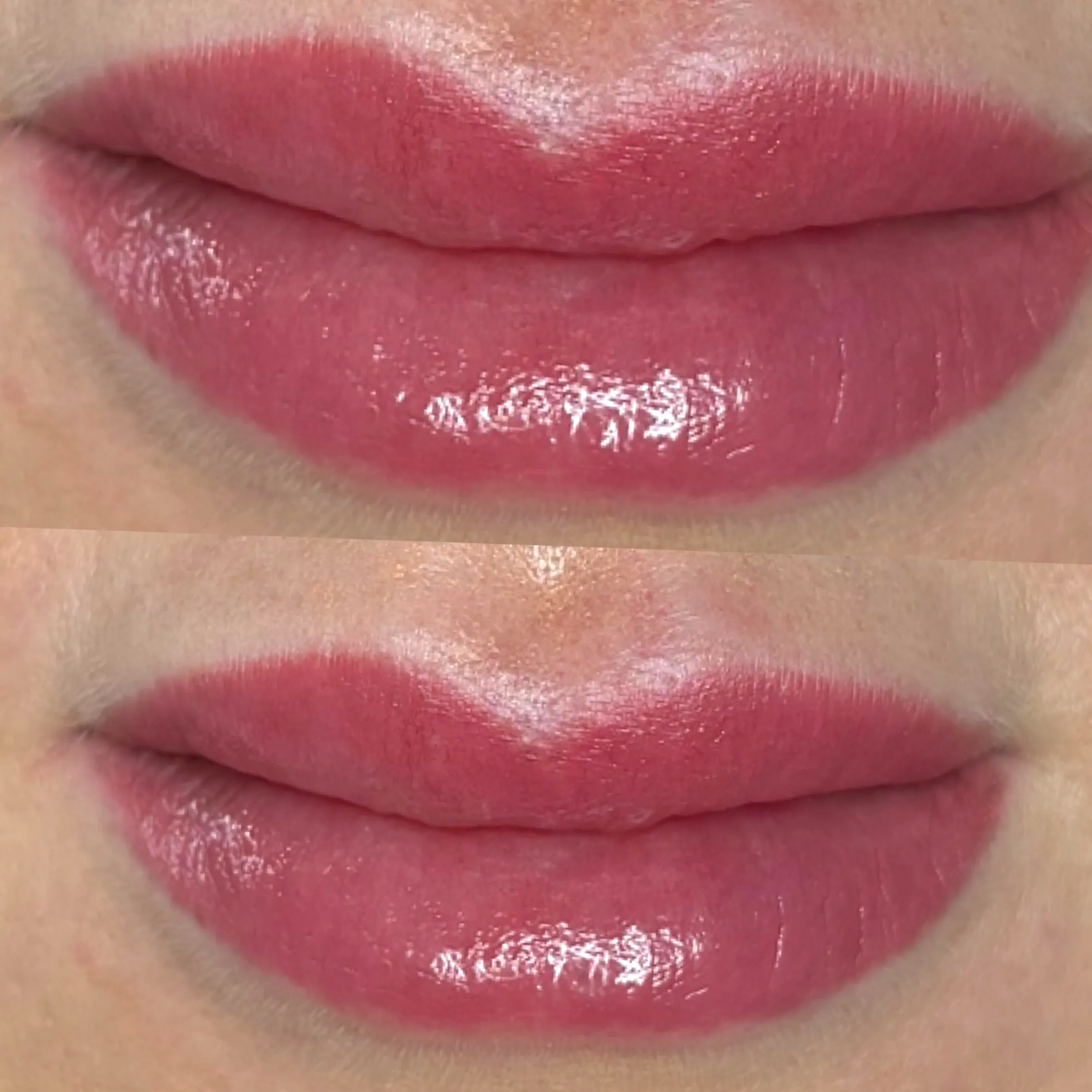 cosmetic tattoo neutralisation
