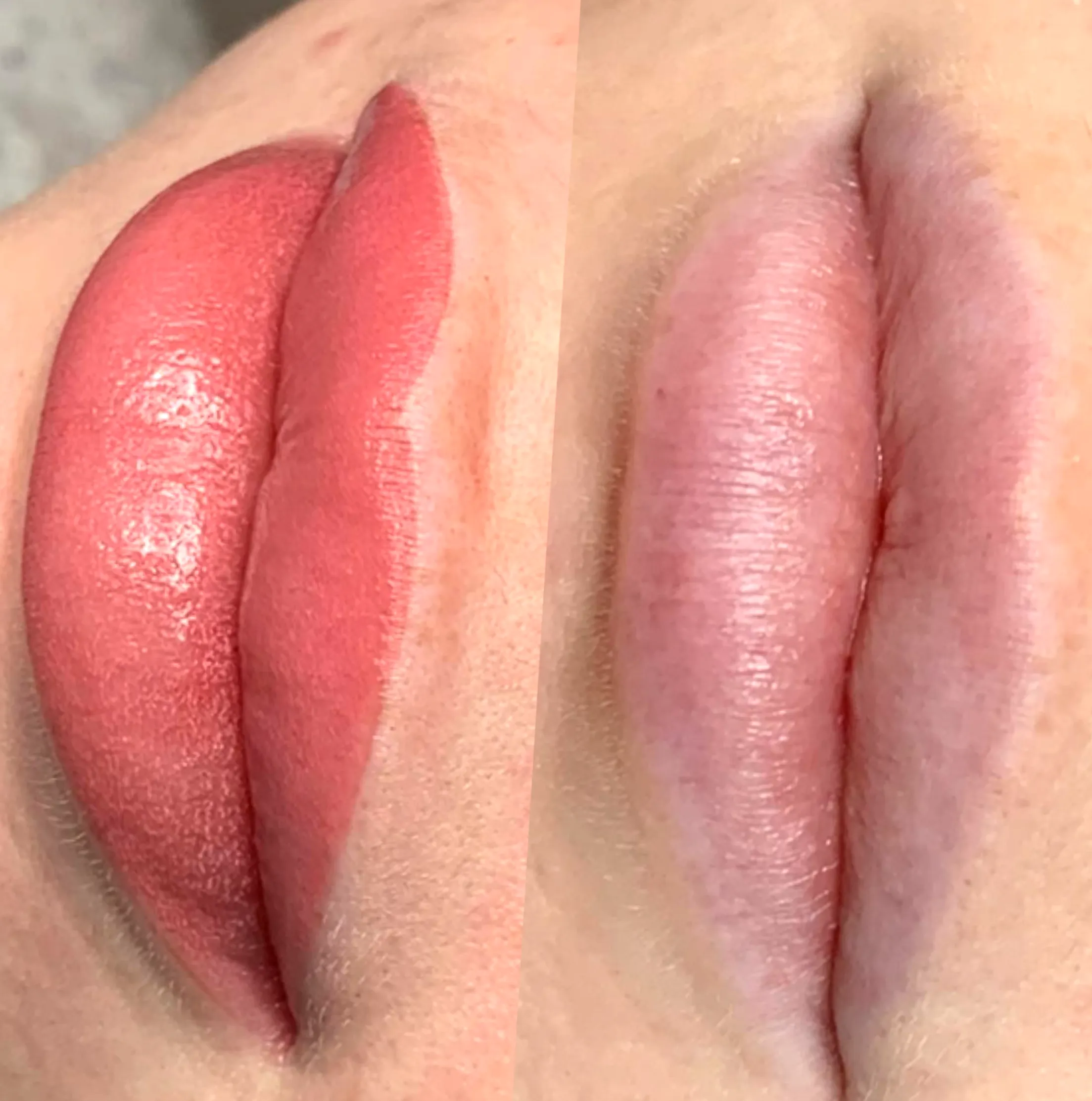 dark lip tattoo correction