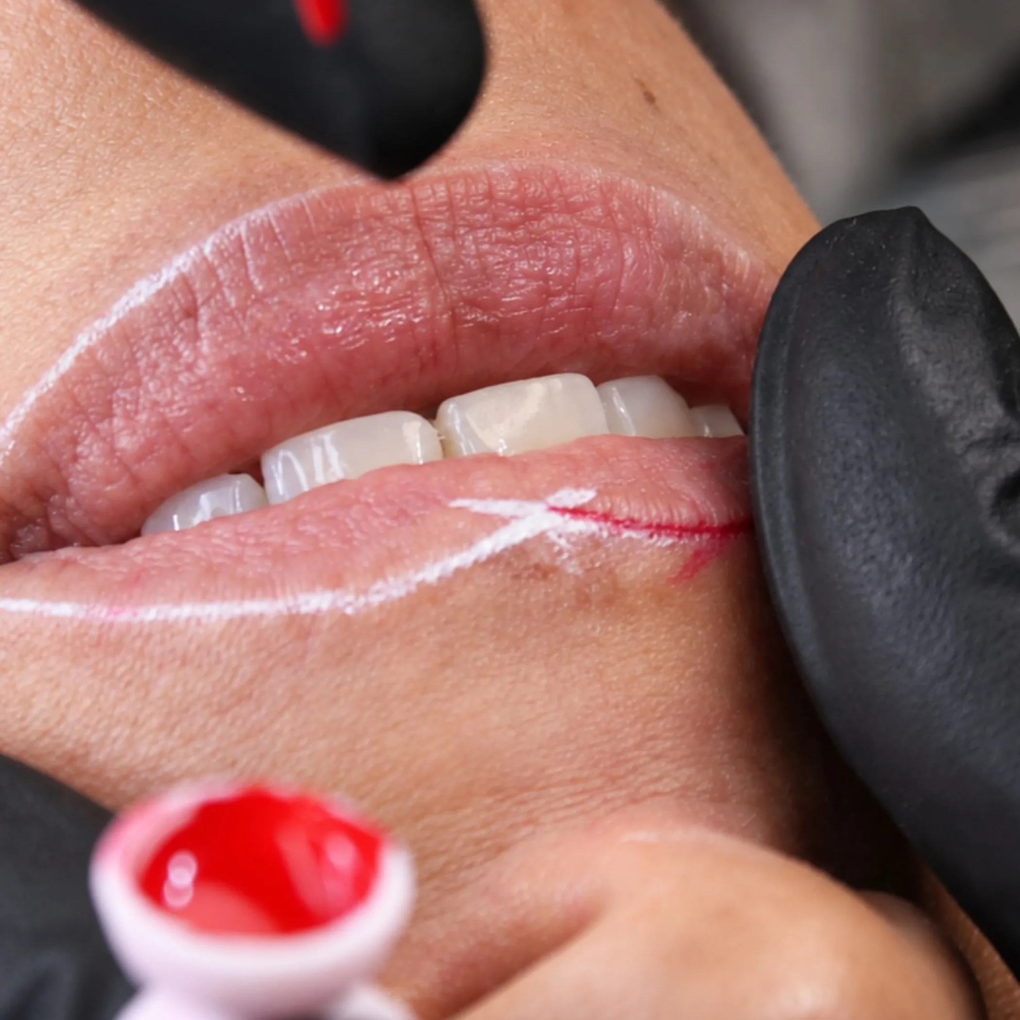 lip neutralisation tattoo procedure