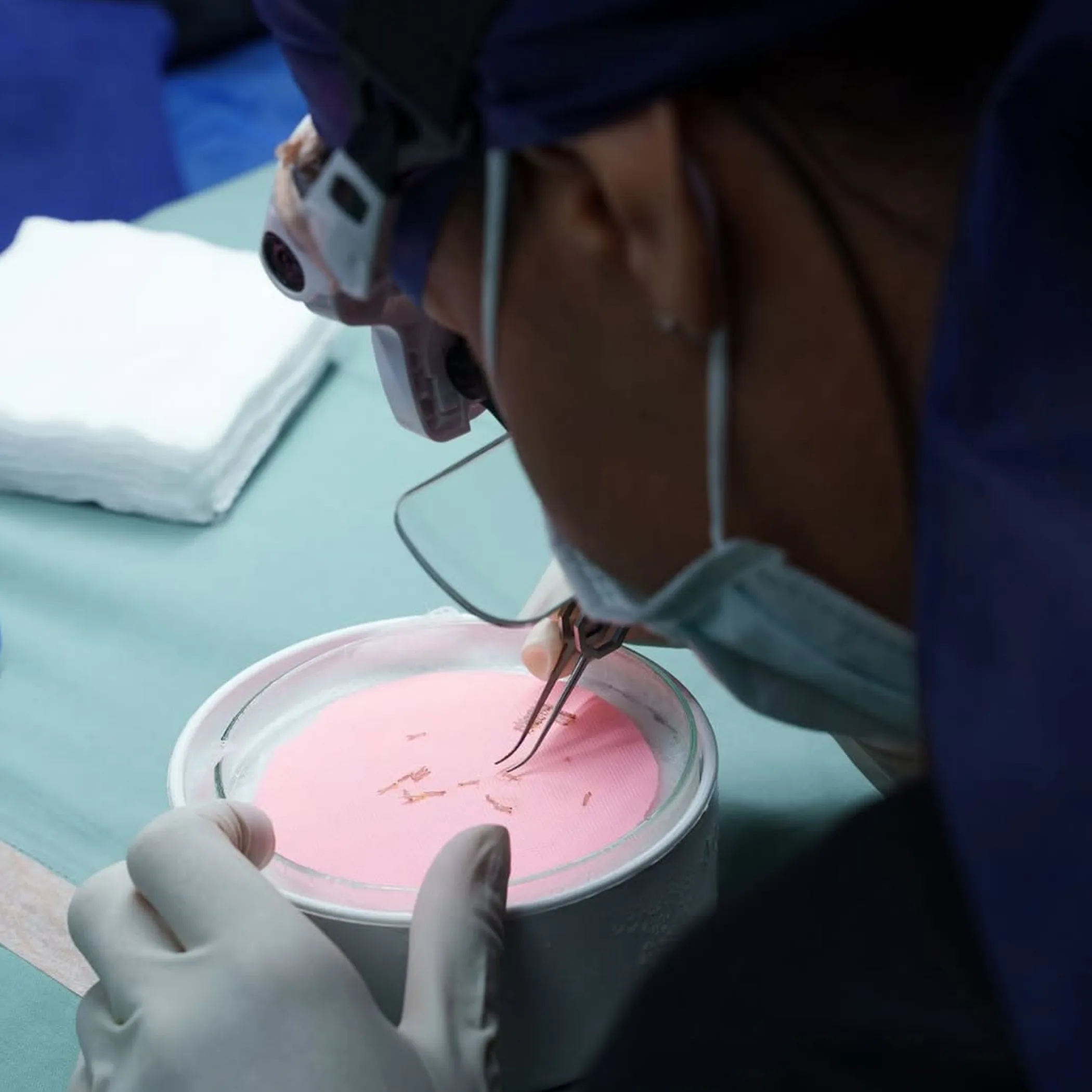 hair transplant preparation procedure