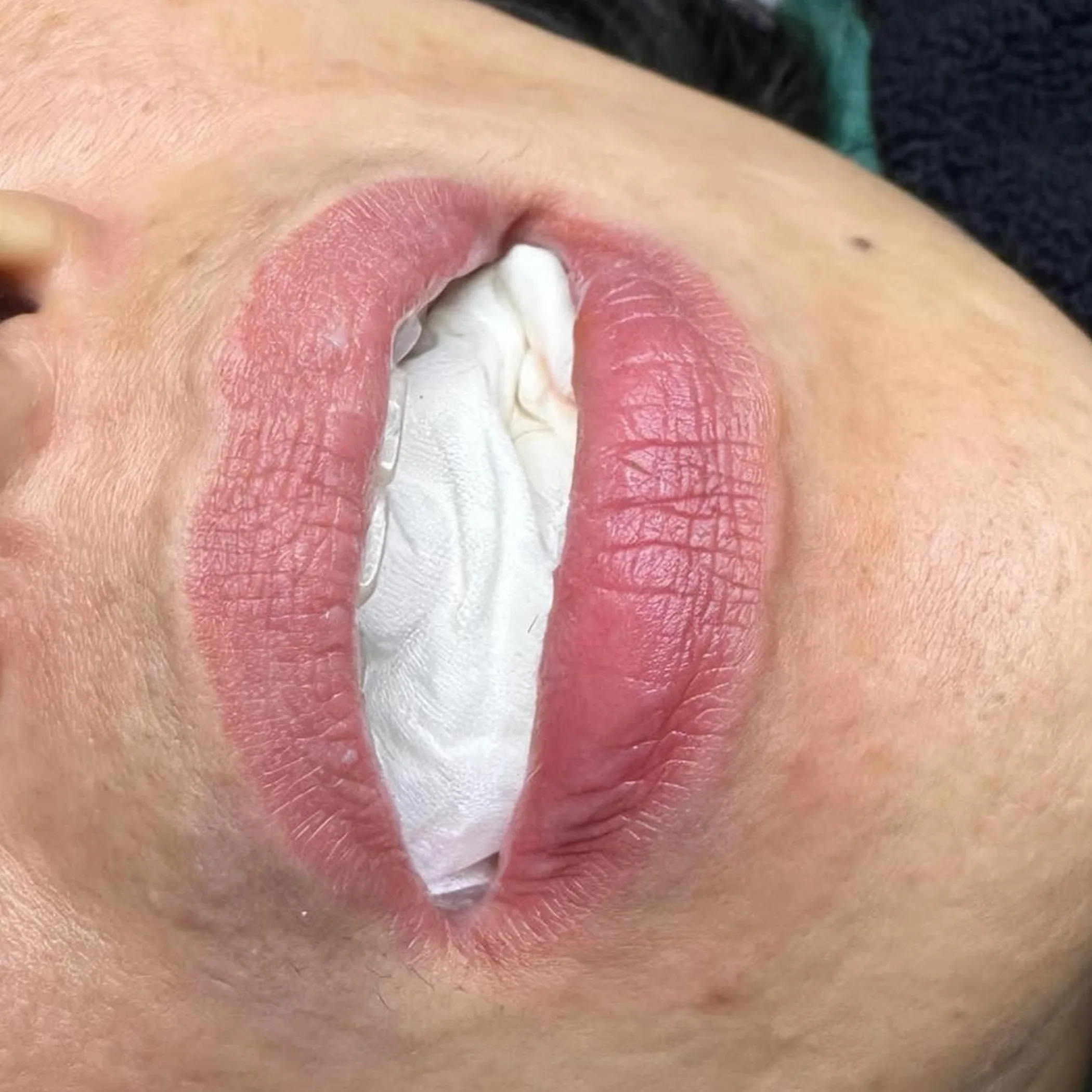 enhanced lip color tattoo procedure